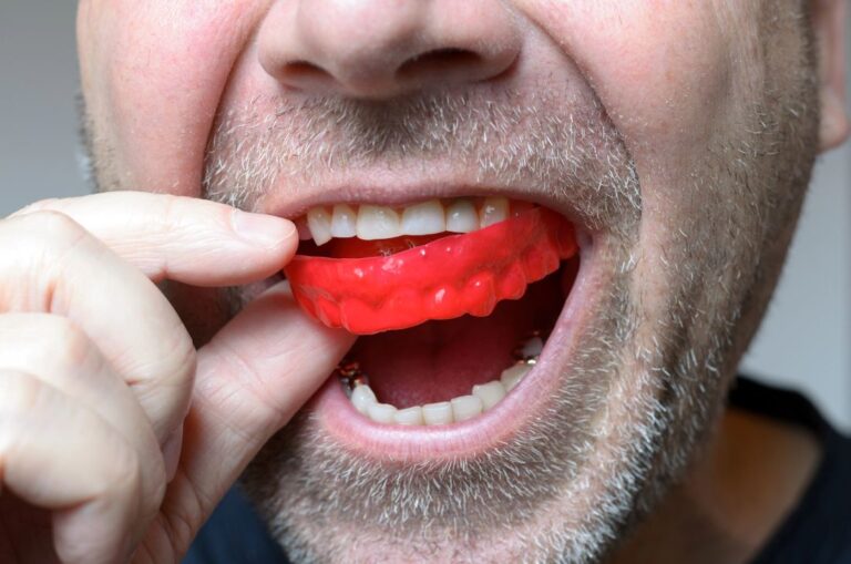 A man inserting a mouthguard to protect teeth from damage due to teeth grinding, highlighting the importance of dental protection in trades.