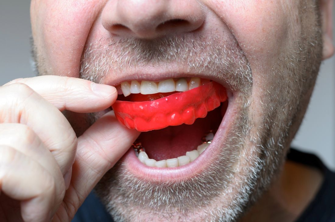 A man inserting a mouthguard to protect teeth from damage due to teeth grinding, highlighting the importance of dental protection in trades.